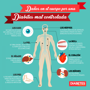 Posibles complicaciones si no se cuida la diabetes