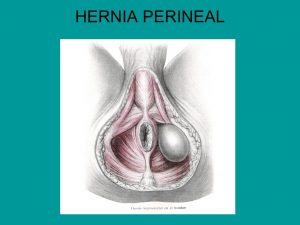 Localización de la hernia perineal