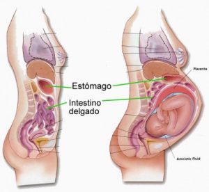 Durante el emabrazo, el feto presiona el estómago propiciando la subida de los ácidos gástricos hacia el esófago.